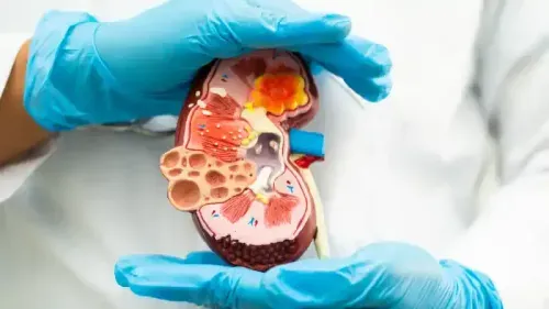 Health Insurance for Polycystic Kidney Disease